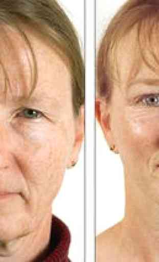 Facial Plastic Surgery: Avant et Après 2