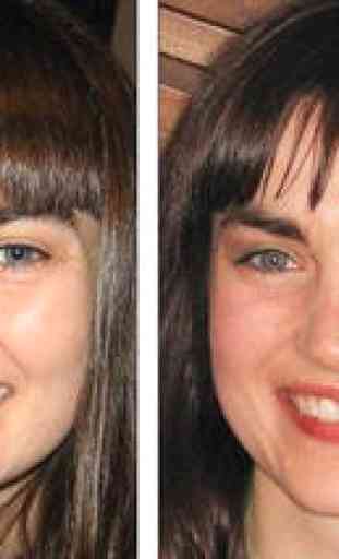 Facial Plastic Surgery: Avant et Après 4