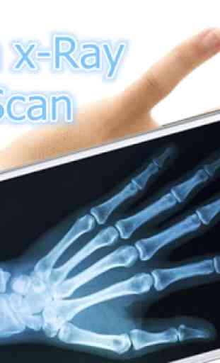 X-Ray Scanner for free 1