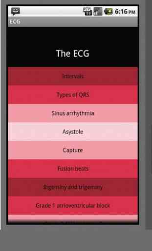 Electrocardiogram ECG Types 1