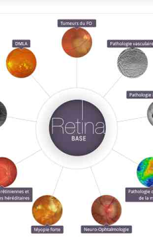 Retina Base 1