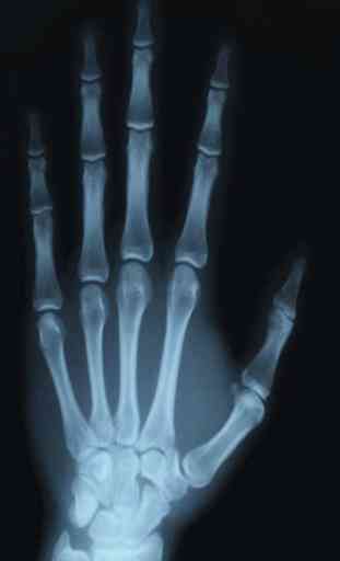 X-Ray Scanner Prank 2