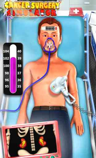 Chirurgie du cancer Simulator 3