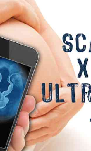 X-Ray Scanner ultrasons Joke 3