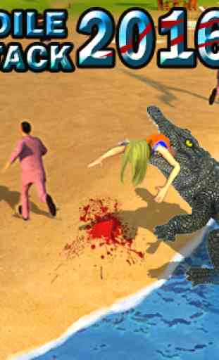 Crocodile Beach Attack 2016 1