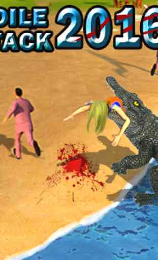 Crocodile Beach Attack 2016 3