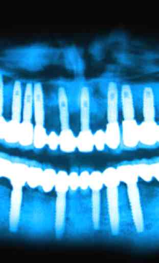X-ray Teeth Joke 2