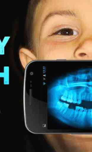 X-ray Teeth Joke 3