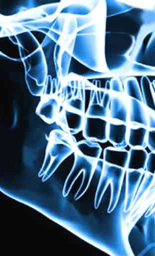 Xray Scanner Teeth Prank 2