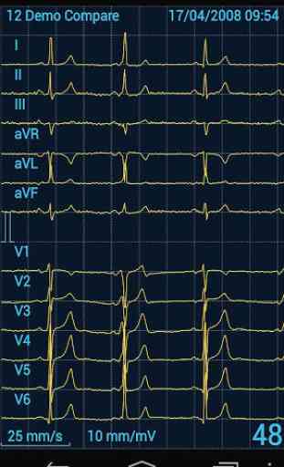 Cardiax Mobile ECG 1