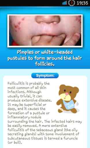 Baby Skin Problem & Guide Lite 3