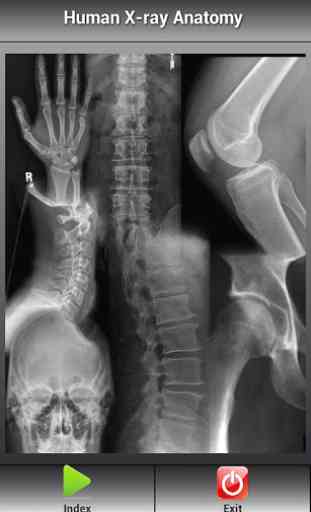 Human X-ray Anatomy 1