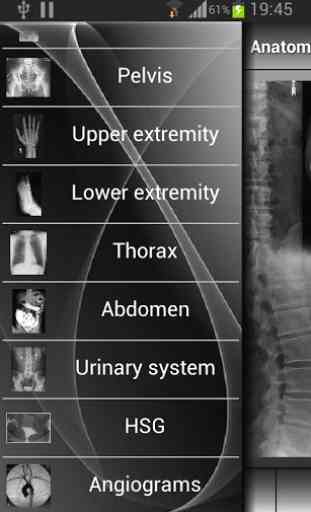 Human X-ray Anatomy 2