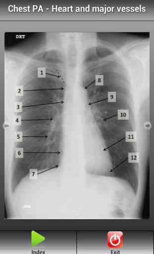 Human X-ray Anatomy 4