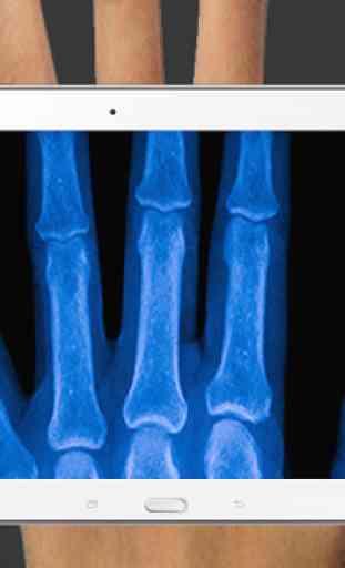X-ray Body Scanner Prank 4