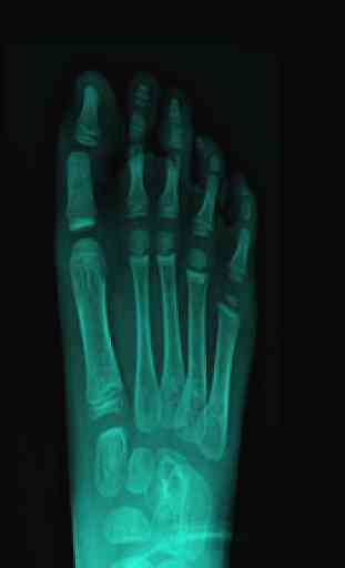X-ray Body Scanner Prank 3