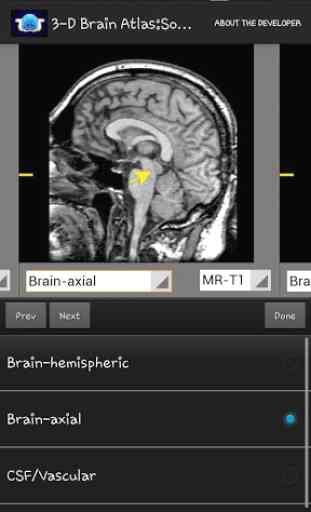 3-D brain Atlas 2
