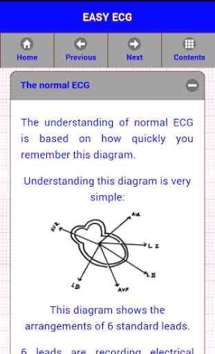 Easy ECG 3