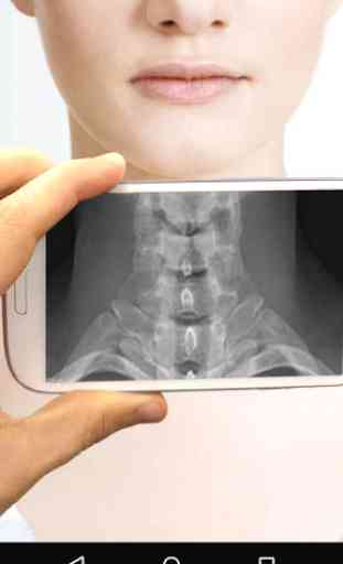 Ultrasound X-ray Scanner Prank 3