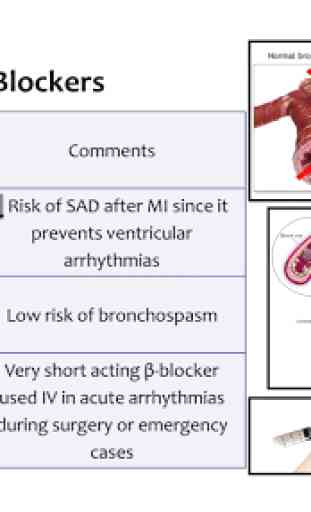 Cardiac Arrhythmia & Treatment 4
