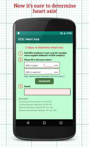 ECG: Heart Axis 1