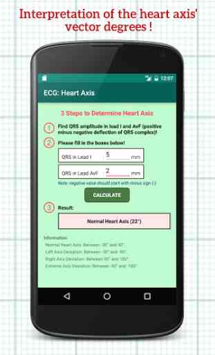 ECG: Heart Axis 2