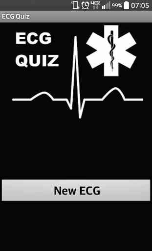 ECG Quiz 1