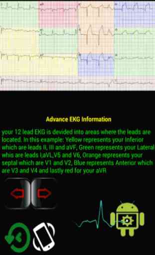 EKG Master Beta Version 2