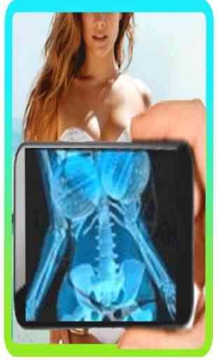 X Ray Body Scanner Prank 4