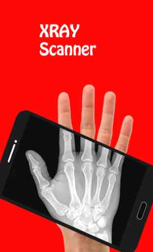 X-Ray Cloth Scanner Prank 1