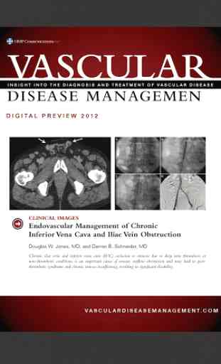 Vascular Disease Management 1