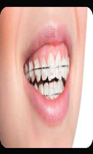 Orthodontique 1