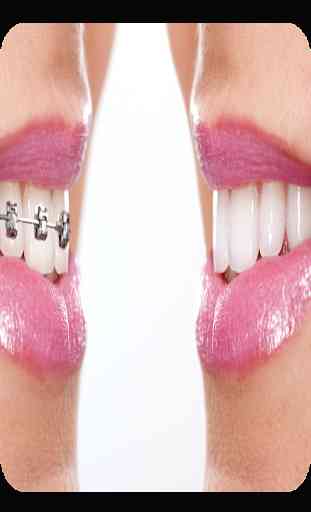Orthodontique 2