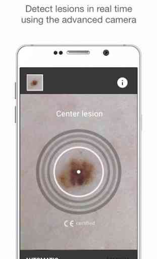 SkinVision - Melanoma app 1