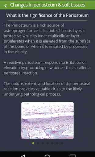 Bone Lesions 3