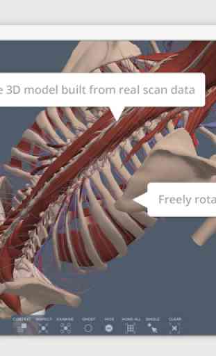 Spine: 3D RT - Sub 1