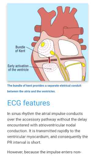 ECG Basics - Learning and interpretation made easy 2
