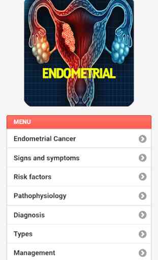 Endometrial Cancer 2