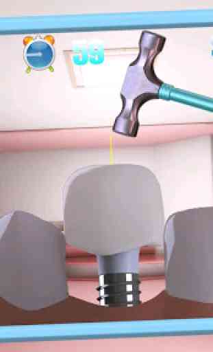 Chirurgie dentiste virtuelle 3