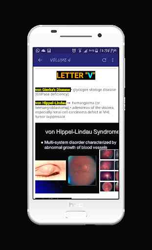 USMLE Step1 & 2 CK Differential Diagnosis 3