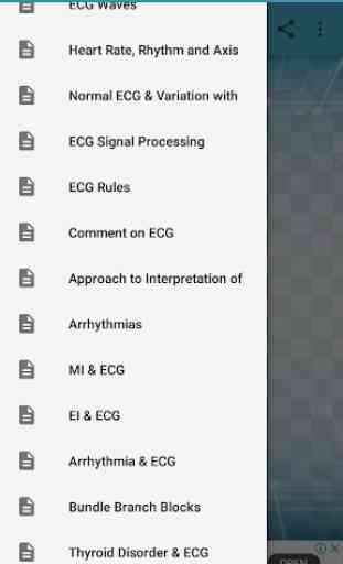 A to Z ECG Interpretation 1