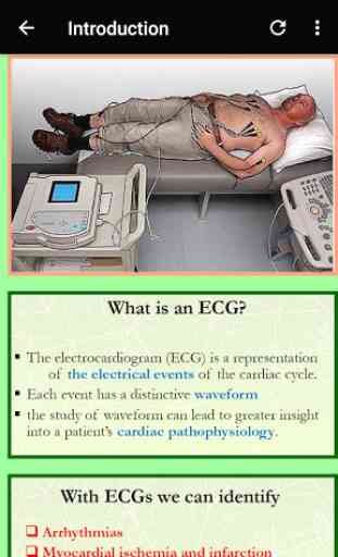 Clinical ECG Interpretation - GUIDE APP 4