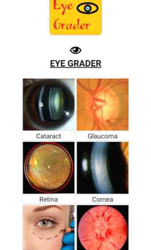 Eye Grader 2