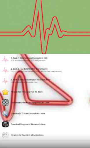 ECG / EKG Rhythm Step-by-Step Interpretation 2