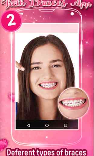 Les Dents Bretelles Application 1