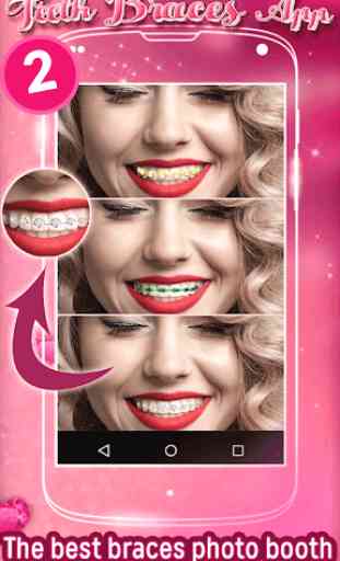 Les Dents Bretelles Application 2