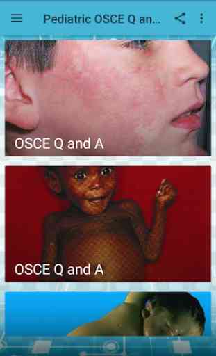 Pediatrics  OSCE Q and A 1