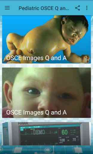 Pediatrics  OSCE Q and A 2