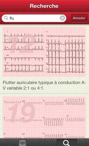 The ECG Collection 2