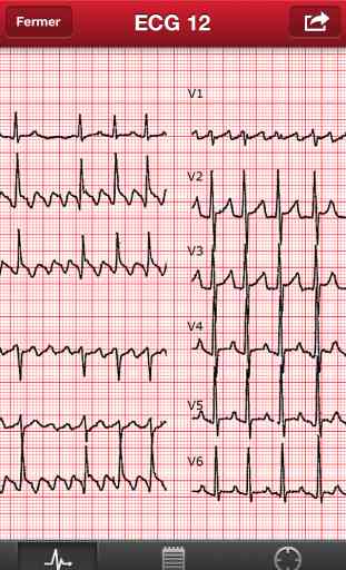 The ECG Collection 3